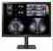 LG medical monitor 31HN713D 31